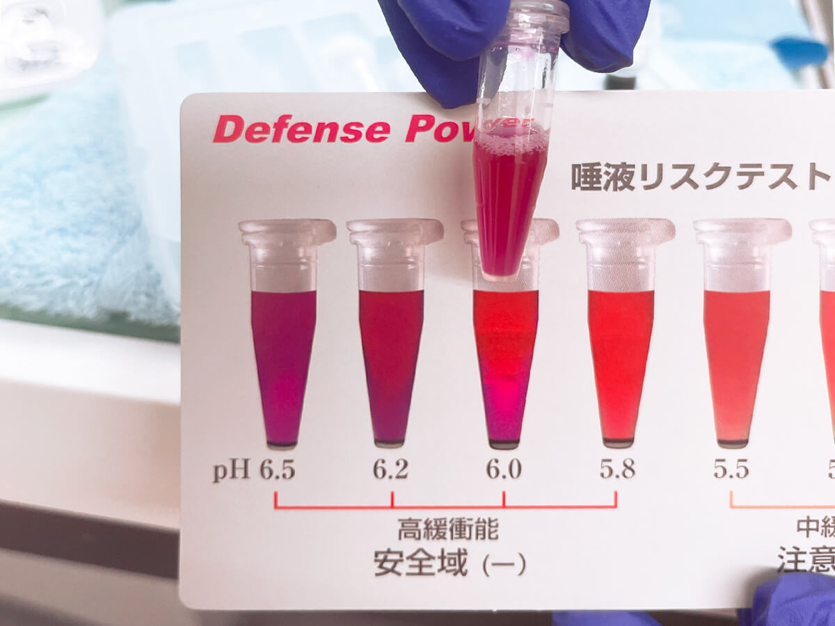 検査結果から行うリスクの評価